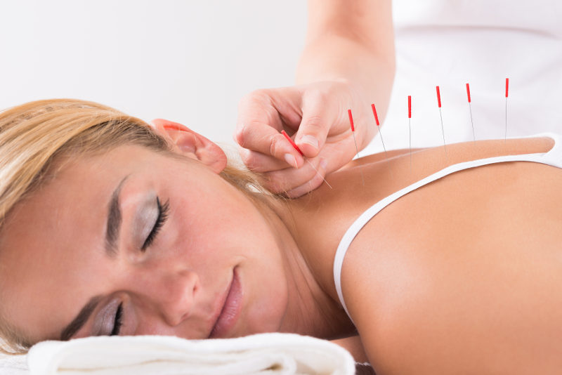 Acupuncture in West Hampstead